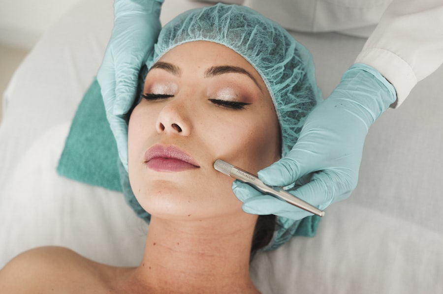 Acne Treatment treatment at Nageeye Hospital