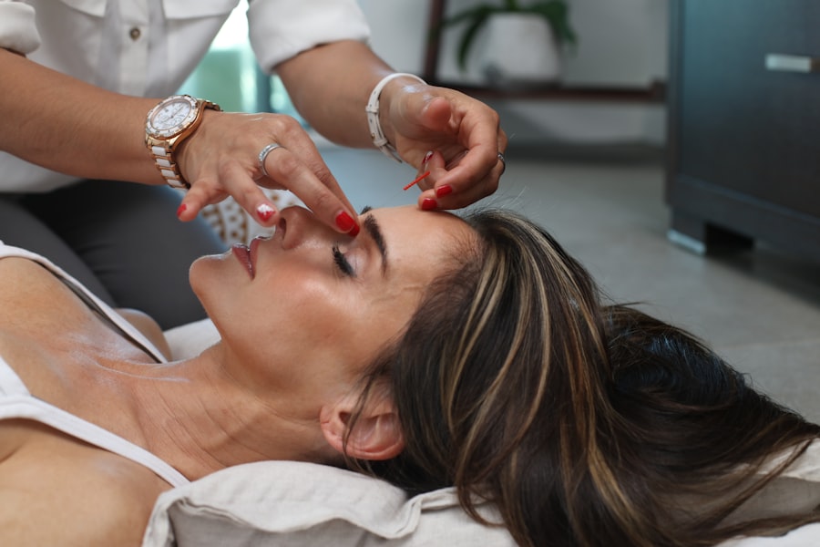Microneedling treatment at Nageeye Hospital